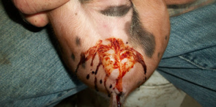 Það sem angistarhrínið merkir